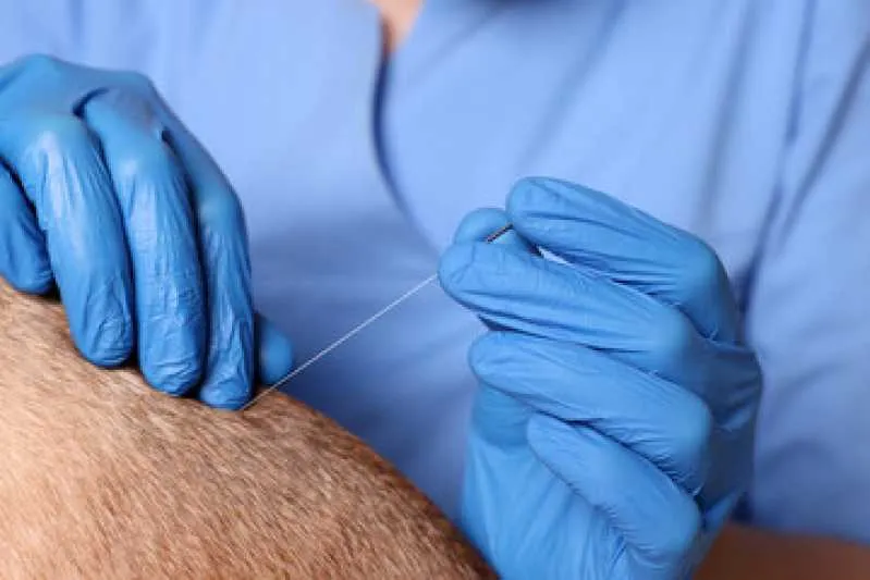 acupuntura em animais de estimação